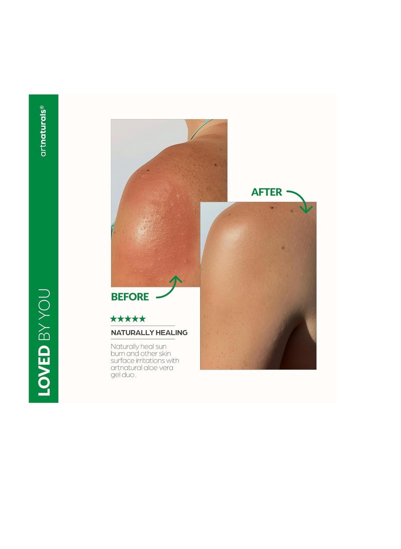 artnaturals Aloe Vera Gel Set - JUMBO 20oz (99% Pure Organic) - Sunburn Relief & Hydration for Face, Body, Scalp & Hair - Calming Moisturizer After Sun Exposure - Freshly Harvested within 12 Hours
