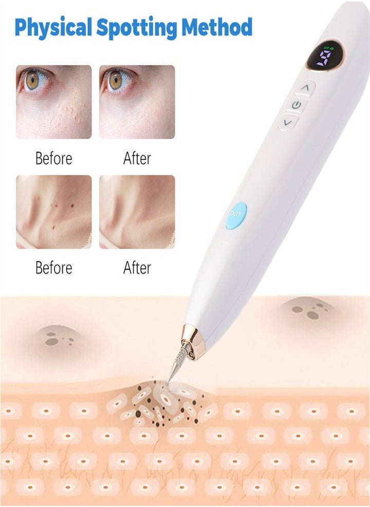 Mole Laser Pointer, Spot Eraser with 9 Modes and LCD Display, Replaceable Needle, USB Rechargeable Mole Removal Pen Skin Tag Removal Tool for Warts Spots Tattoos Body Freckles