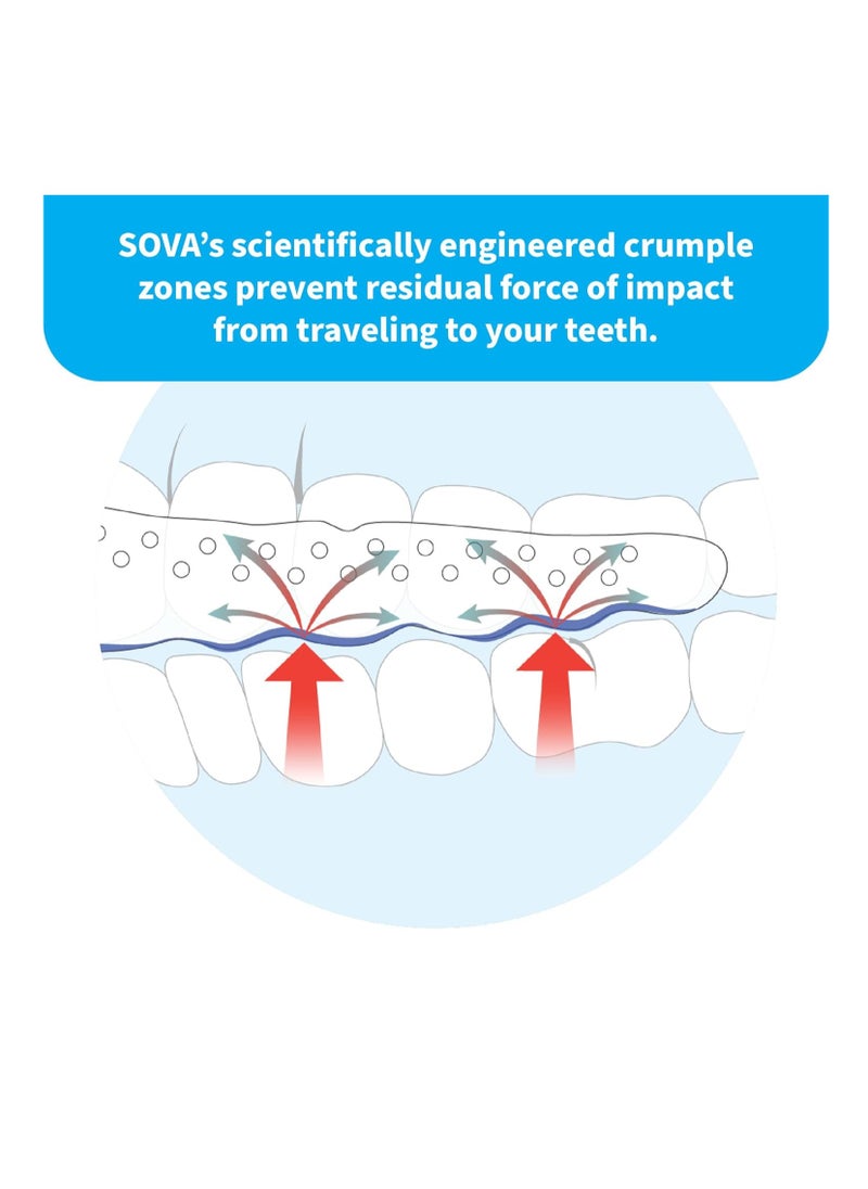 SOVA Aero Night Guard - 1.6mm Thin - Custom-Molded Fit - Protects Against Nighttime Teeth Grinding & Clenching - Odor & Taste Free - Remoldable Up to 20 Times - Non Toxic