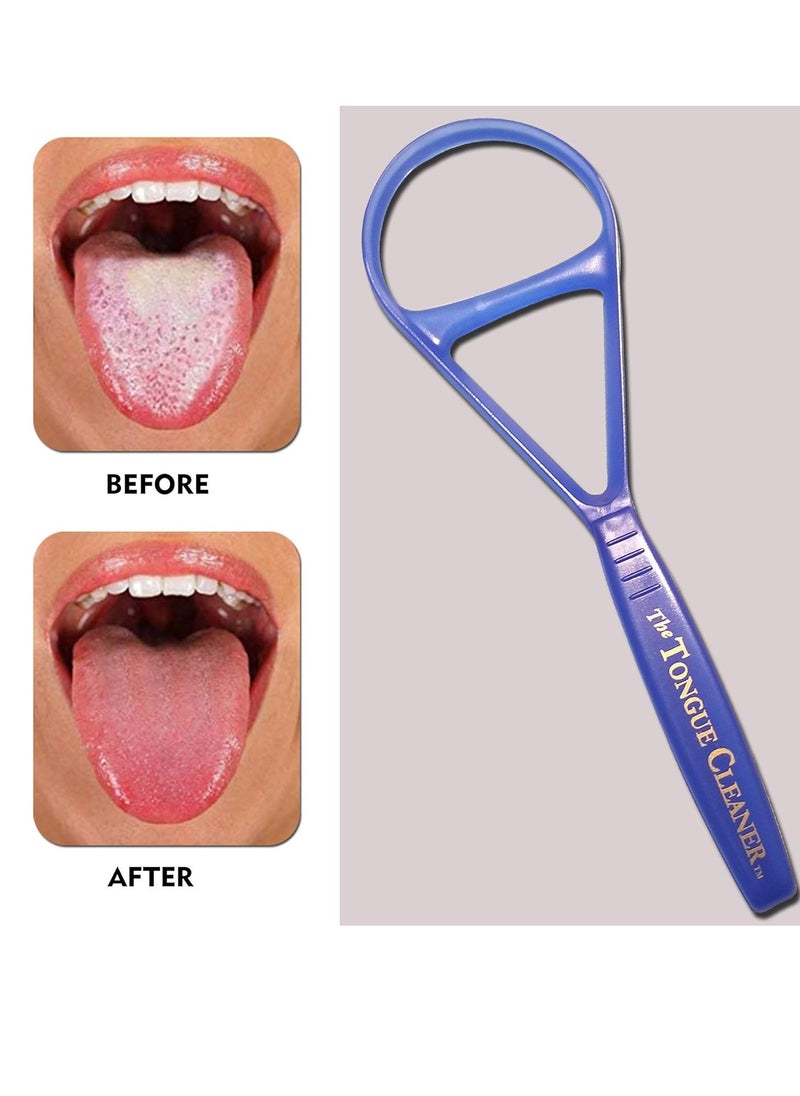 Tongue Scraper Cleaner - the Tongue Cleaner - End Bad Breath and Freshens Breath - Eliminate Bad Breath - Bad Breath Treatment (Color May Vary)