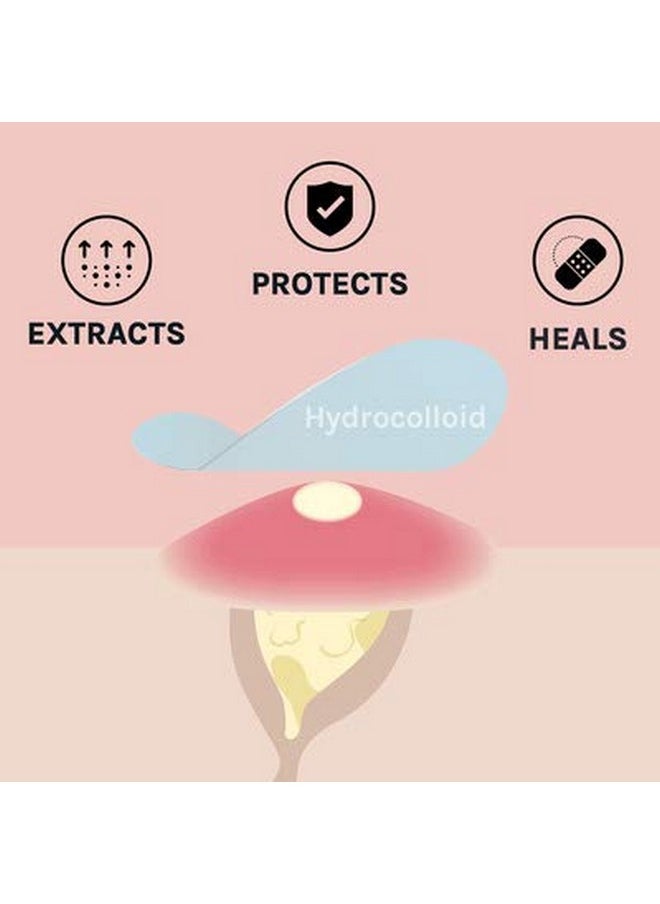 Absorbing Cover Healing Invisible Acne Patch Blemish Spot, Treatment, Facial Acne Patch Vegan, Cruelty Free, Hydrocolloid, Two Sizes 10Mm 12Mm (Total 84 Counts)