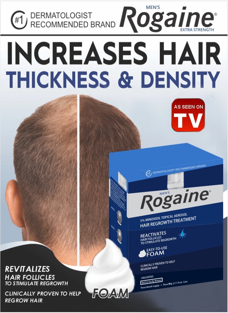 Rogaine White 5% Minoxidil Foam – Hair Loss Treatment (3 Months)