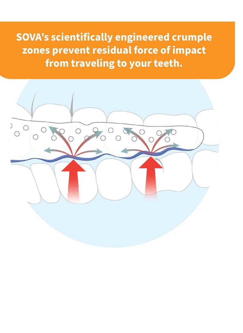 SOVA Junior Night Guard, Purple Punch - 1.6mm Thin - Custom-Molded Fit - Protects Against Nighttime Teeth Grinding & Clenching - Odor & Taste Free - Remoldable Up to 20 Times - Non Toxic