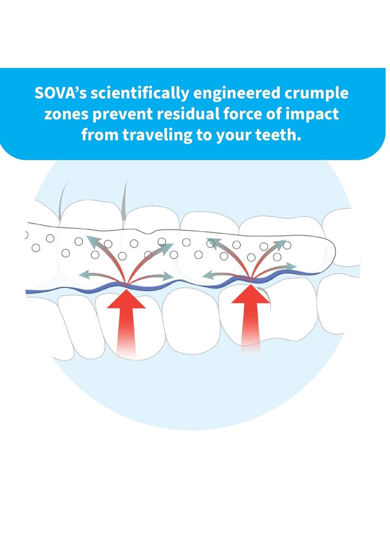 SOVA Aero Night Guard with Case - 1.6mm Thin - Custom-Molded Fit - Protects Against Nighttime Teeth Grinding & Clenching - Odor & Taste Free - Remoldable Up to 20 Times - Non Toxic