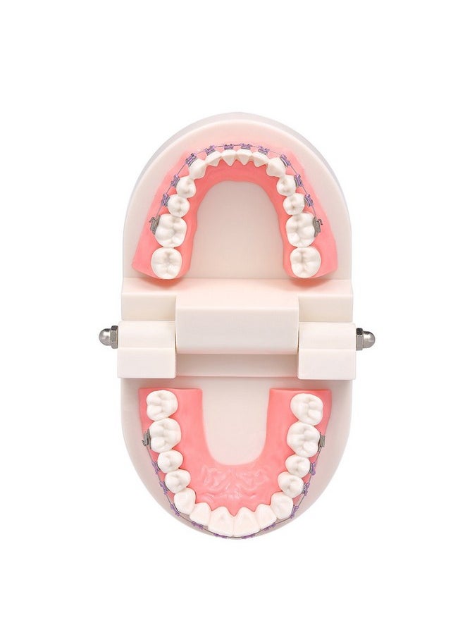 1 Piece Dental Demonstration Orthodontic Model With Metal Wires And Bracket (Metal Bracket)