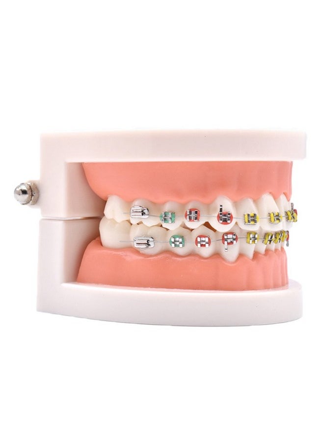 1 Piece Dental Demonstration Orthodontic Model With Metal Wires And Bracket (Metal Bracket)