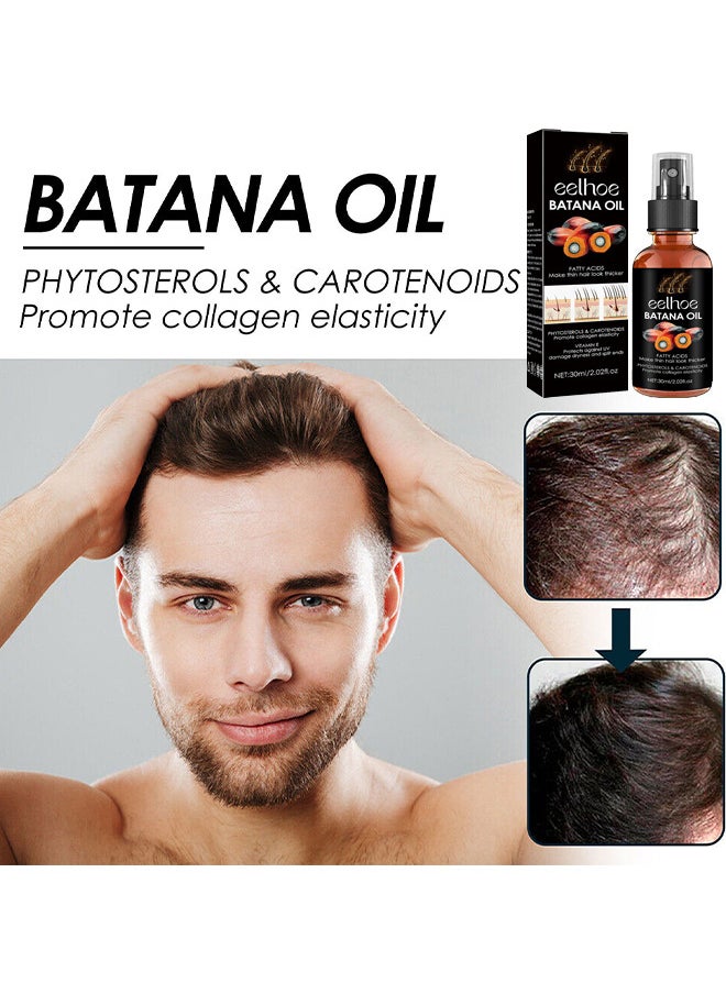 Batana Oil For Hair Growth, Batana Oil Organic For Healthy Hair, Repair Damaged Hair, Nourishes Thin Hair Scalp Skin And Loss Hair Growth Fir, Reduces Hair Loss, 30ML