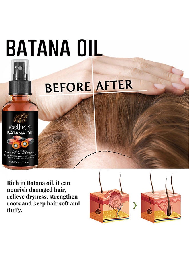 Batana Oil For Hair Growth, Batana Oil Organic For Healthy Hair, Repair Damaged Hair, Nourishes Thin Hair Scalp Skin And Loss Hair Growth Fir, Reduces Hair Loss, 30ML