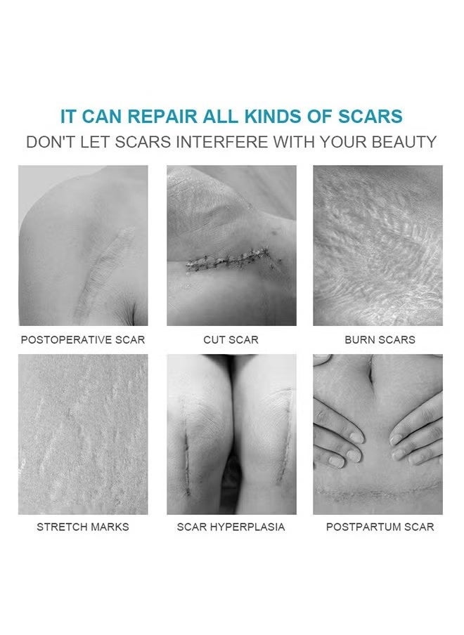 Scar Disappears-Medical Grade Silicone Scar Cream Advanced Scar Removal Gel For Surgical Scars Stretch Marks Acne Injury Burns Keloids Hypertrophic Old And New Scars