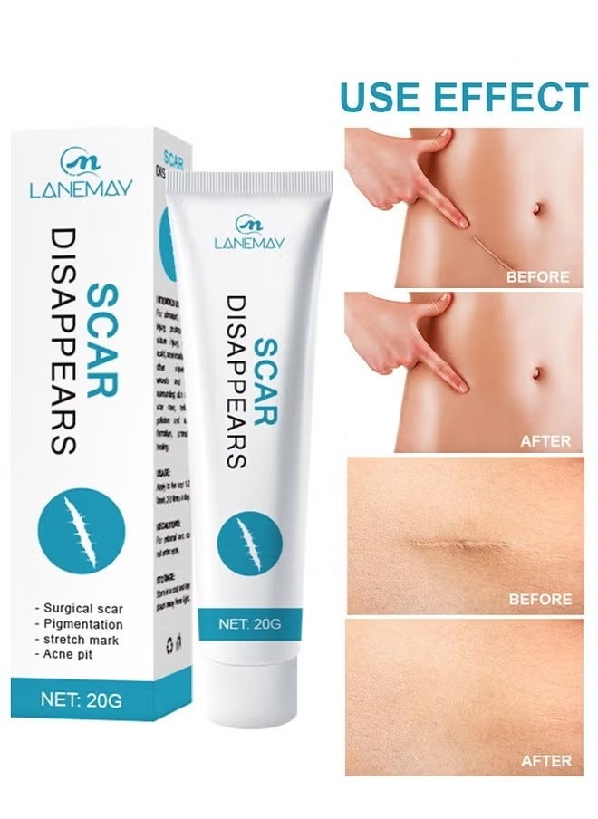 Scar Disappears-Medical Grade Silicone Scar Cream Advanced Scar Removal Gel For Surgical Scars Stretch Marks Acne Injury Burns Keloids Hypertrophic Old And New Scars