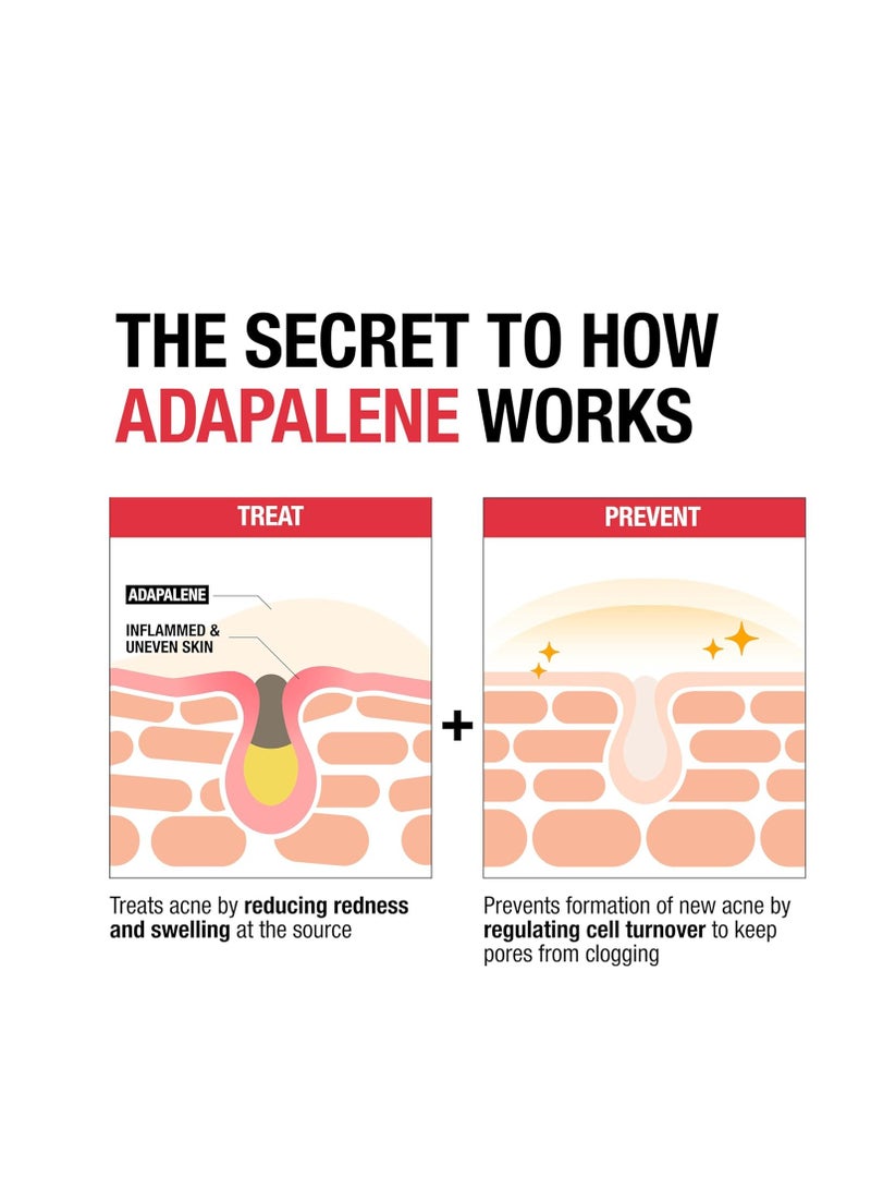 Adapalene Gel Acne Treatment, 0.1% Adapalene Acne Medication for Pimples & Blemishes, Once Daily Topical Retinoid Gel to Help Fight Breakouts, Oil- & Fragrance-Free, 1.6 oz 45 ggrams