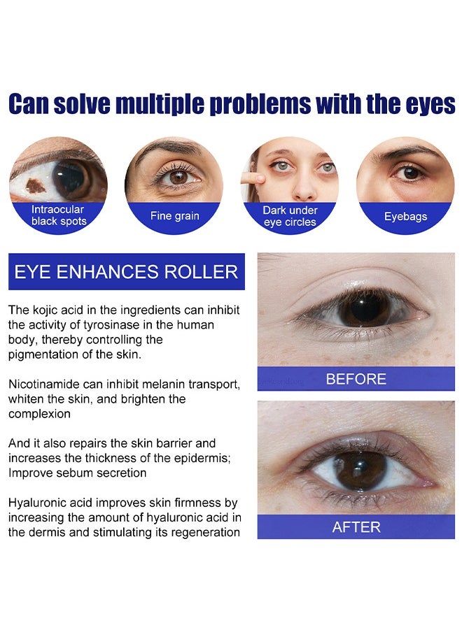 Eye Enhancing Roller, with Hyaluronic Acid, Kojic Acid, Coffee Extract Eye Serum for Puffy Eyes and Dark Circles, Relieve Eye Fatigue, Lift Firm and Reduce Wrinkles and Fine Lines 15ML