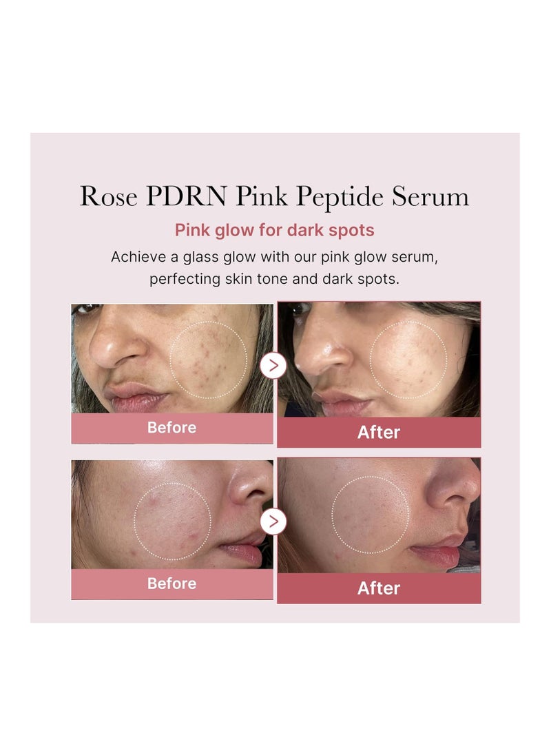 Medicube PDRN Pink Peptide Serum, Pink glow serum, Vegan PDRN, Peptide, Niacinamide, Hydrating & Moisturizing & Firming, Uneven Skin Tone, Pore Care, Korean Skincare