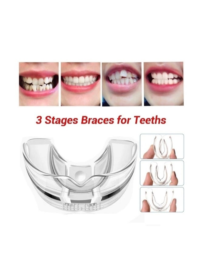 Multi Functional Invisible Brace 1 2 3 Stages Soft and Hard Tooth Orthodontic Tooth Correct Appliance Aligners Trays Teeth Straightener High-Tech Dental Transparent Teeth Retainer