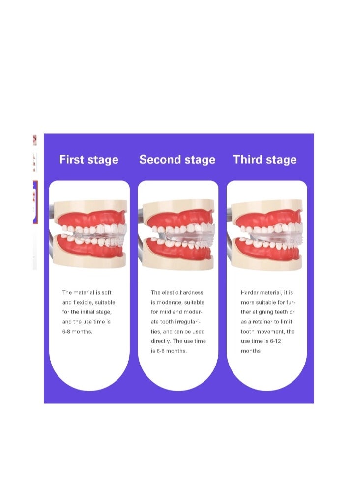 Multi Functional Invisible Brace 1 2 3 Stages Soft and Hard Tooth Orthodontic Tooth Correct Appliance Aligners Trays Teeth Straightener High-Tech Dental Transparent Teeth Retainer