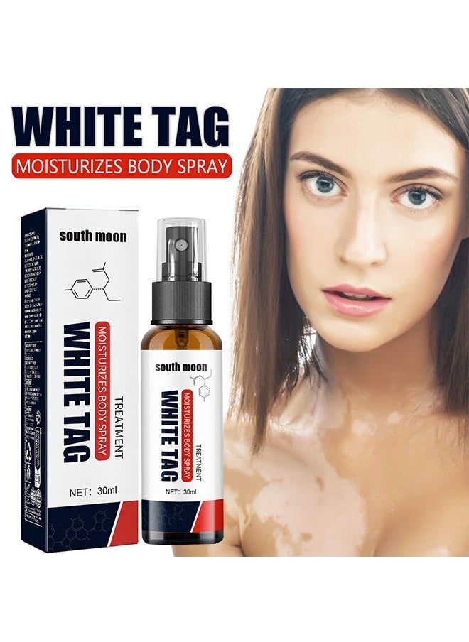 Treatment Moisturizes Body Spray White Tag,White Tag Spot Remover Spray Vitiligo Ointment, For Skin Vitiligo, Vitiligo Care Cream For Reduce White Spots Repair Spray 30ml