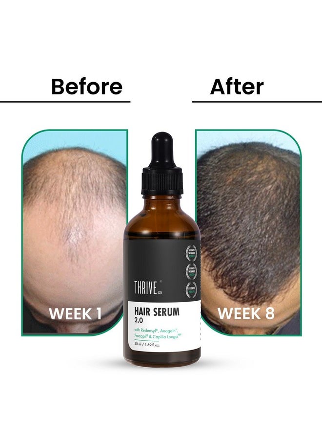 Hair Growth Serum 2.0 For Hair Growth & Hair Fall Control | With Redensyl + Anagain + Rosemary + Procapil + Capilia Longa | For Men & Women | 50Ml