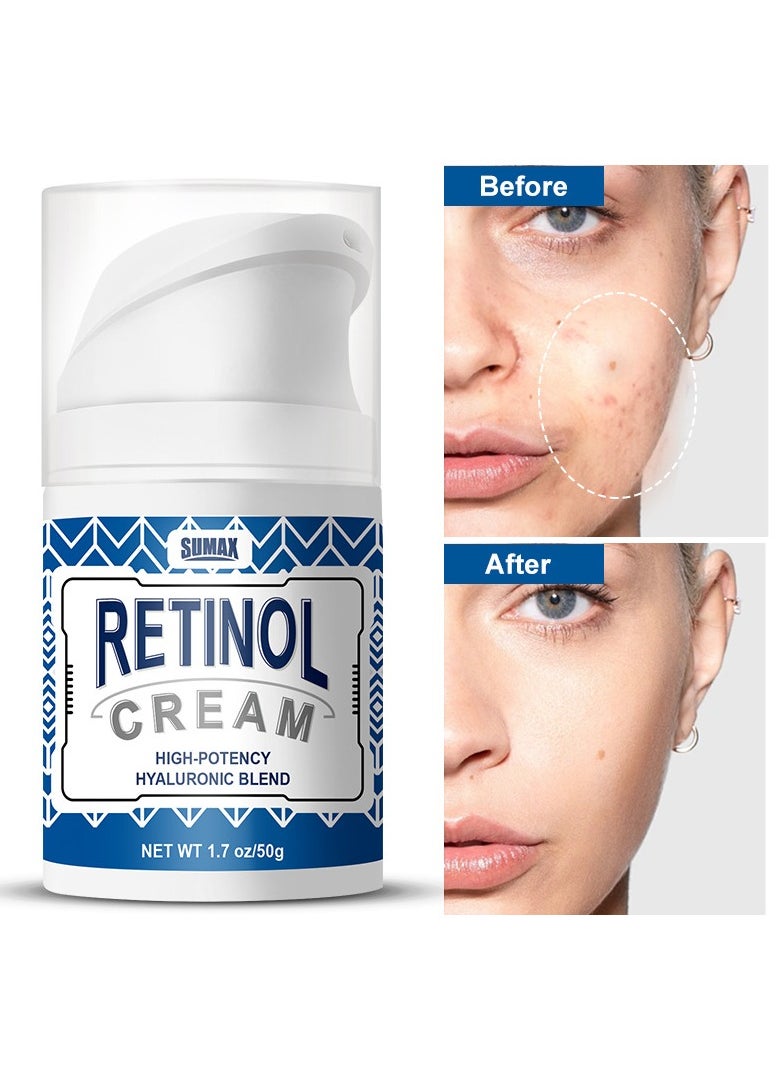 Retinol Pressed Cream, Reduces Fine Lines, Anti-Wrinkle, Firms 50ml