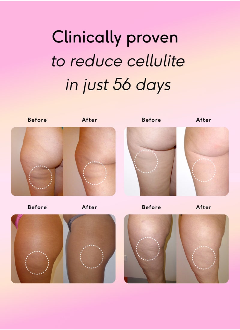 Feel Smooth Skin Anti Cellulite Capsules for Women, Smooth Legs & Thighs, Reduce Cellulite & Crepey Skin w/Clinically Studied SOD (1 Month Supply 30 capsules)