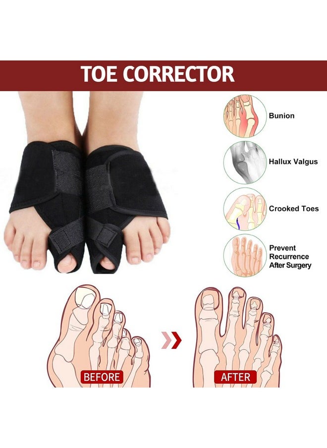 Toe Separator For Men Adjustable Bunion Corrector Toe Straightener Hallux Valgus Splint For Women Orthopedic Tight Fitting Band Foot Thumb Supporter Brace For Pain Relief (1 Pair) (Without Rope)