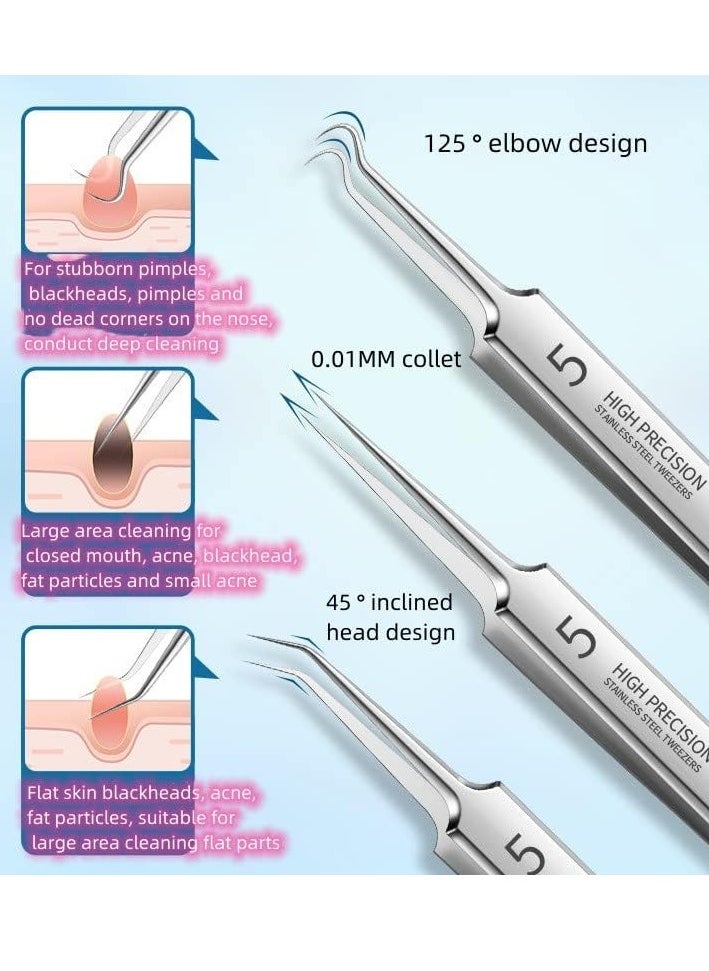 Professional Facial Blackhead Remover Tweezers,Extractor Acne Removal Kit Pimple Popper Tool, Clip for Whiteheads, Acne Clip, Ingrown Hairs Tweezers, Blackheads Remover Extractor, Stainless Steel