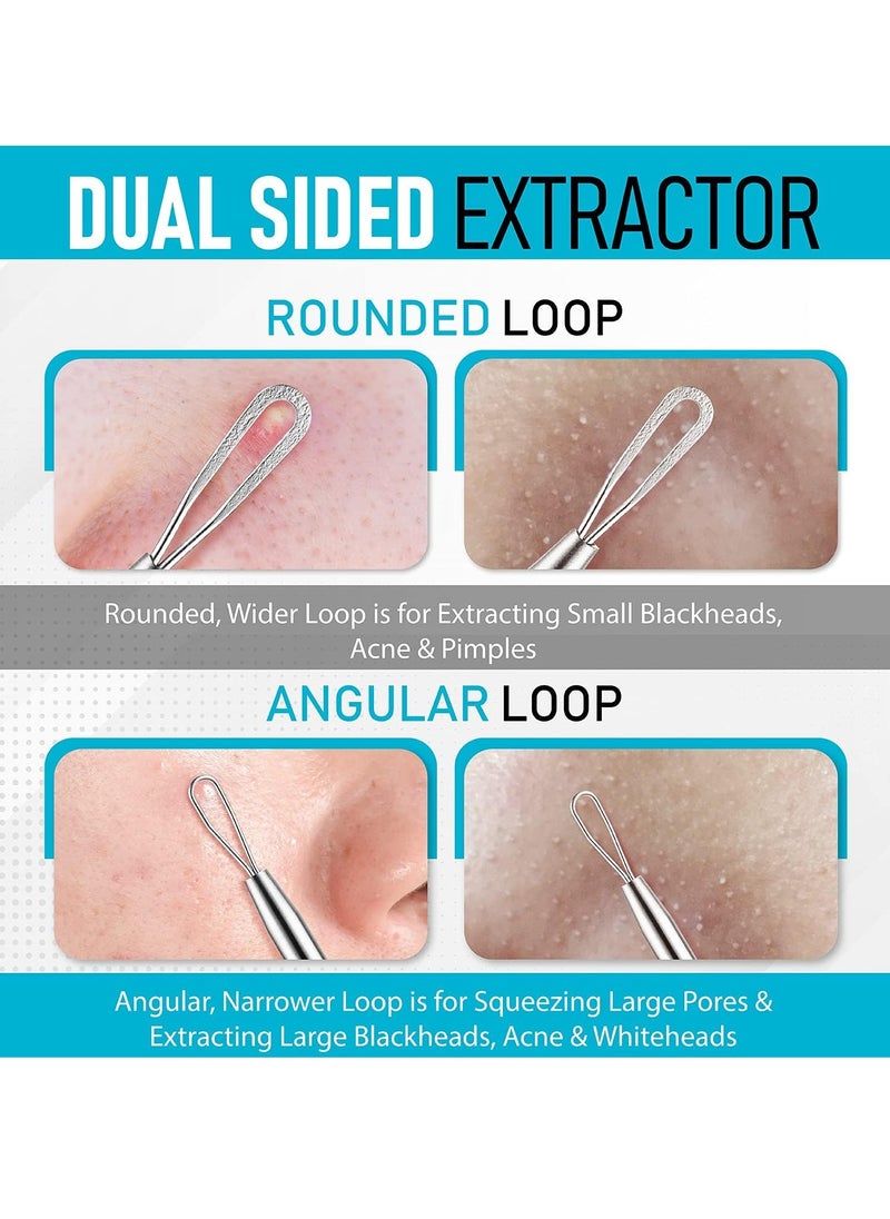 Hula Home Blackhead Remover Pimple Extractor Popper Tool Acne Comedone Blackhead, Blemish, Whitehead Popping, Zit Removing for Nose Face, 304 - Stainless Steel