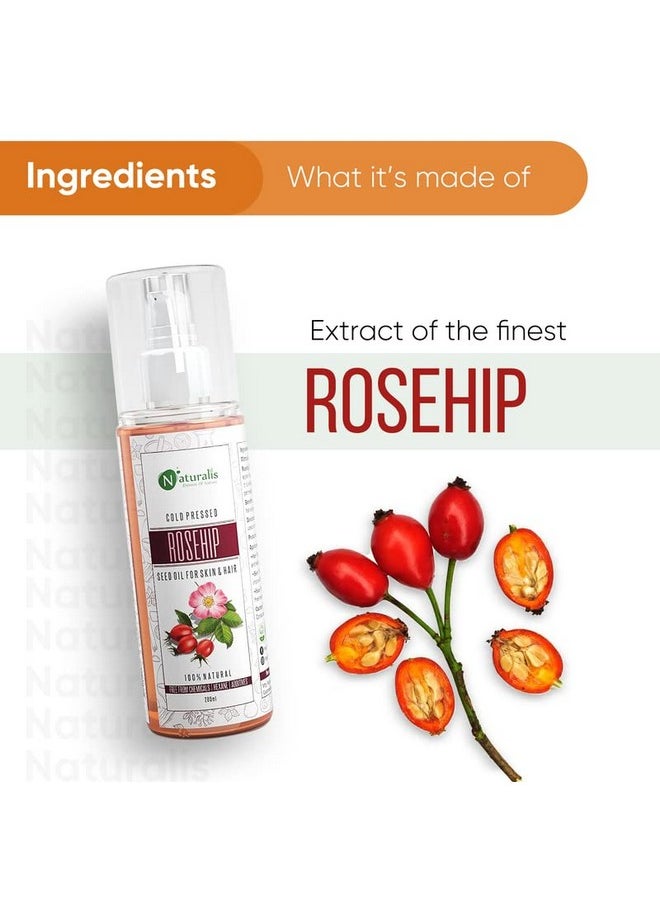 Essence Of Nature Cold Pressed Rosehip Carrier Oil For Skin Lightening, Pigmentation, Stretch Marks, Acne Scars, Wrinkles, Aging, 200 Ml