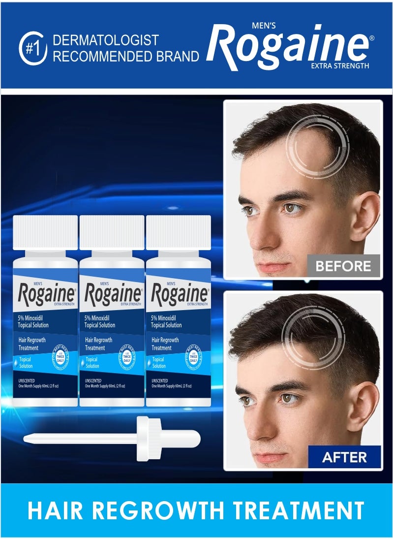 Men's Rogaine 3x60ml Extra Strength – Effective Hair Loss Treatment