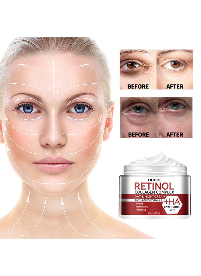 Retinol Collagen Complex, 30g Anti Aging Cream With Hyaluronic Acid And Collagen, Wrinkle Removal Skin Firming Cream, Retinol Moisturizer Cream For Skin Tightening, Dry Lines And Fine Lines