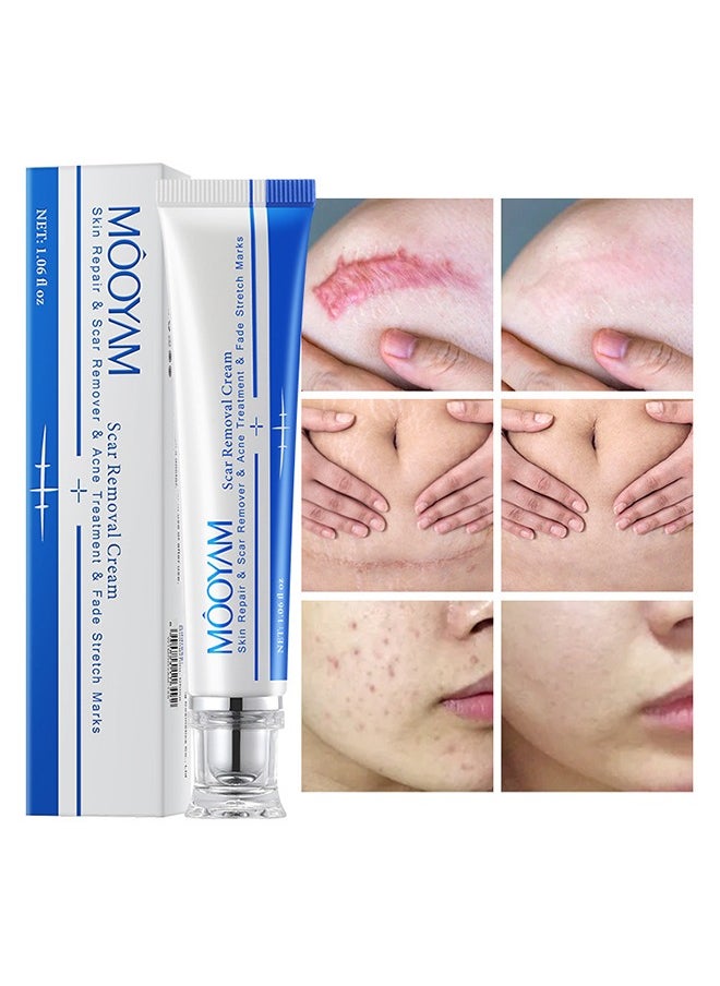 Scar Removal Cream, Skin Repair & Scar Remover & Acne Treatment & Fade Stretch Marks, Skin Repairing Cream Fade Scars/Stretch Marks/Acne Treatment, Improve Scar Skin, Deeply Moisturizes Skin