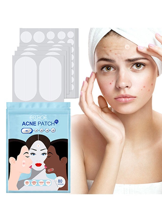 Acne Patch - 5 Sizes Of Patch Healing Acne And Pustule Can Be Used Day And Night , Acne patch can be made up IOnvisible Acne-Clearing Anti-acne-Closing Acne Waterproof Concealer Hydrocolloidal Acne Patch 80 Patches