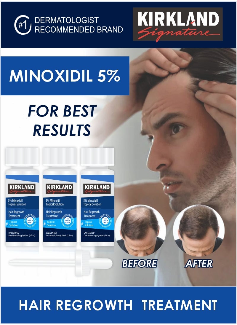 3-Month Minoxidil 5% Solution for Men – Proven Hair Regrowth Treatment