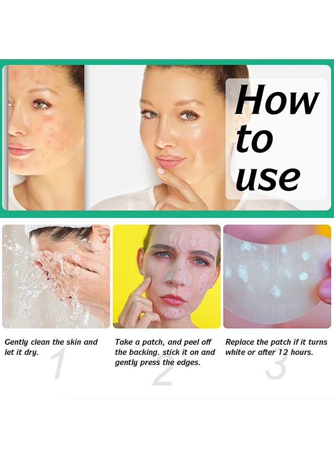 10 Facial Acne Patches - Hydrocolloid Acne Patches to Cover Pimples and Blemishes - Acne Patches for Skin Care