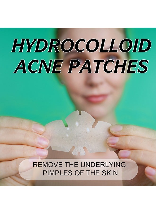 10 Facial Acne Patches - Hydrocolloid Acne Patches to Cover Pimples and Blemishes - Acne Patches for Skin Care