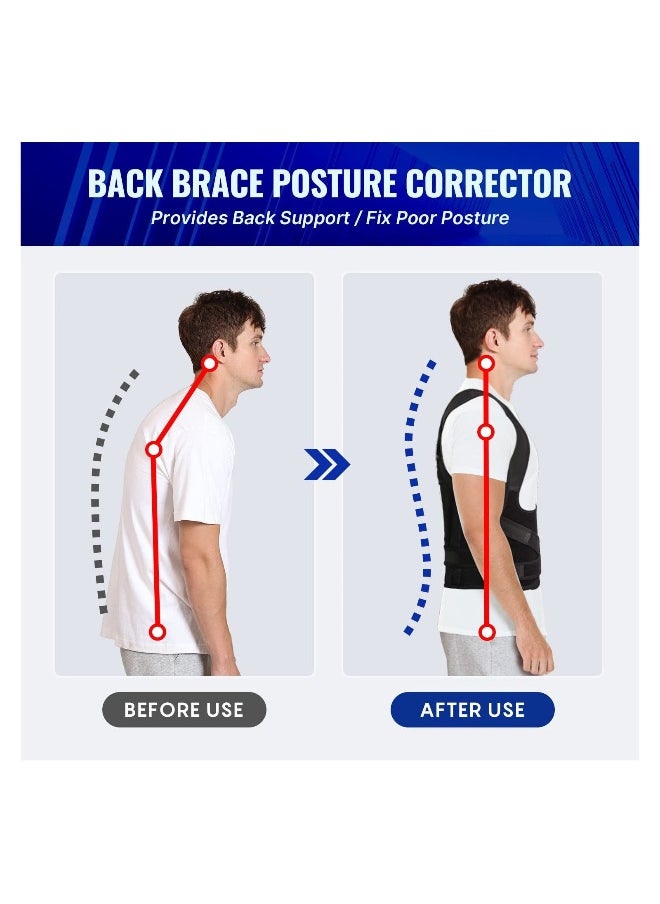 Back Brace and Posture Corrector for Women and Men, Breathable Back Straightener Posture Corrector, Adjustable Scoliosis Back Brace and Hunchback Correction, Spine Corrector, Large (Waist 41-49 Inch)