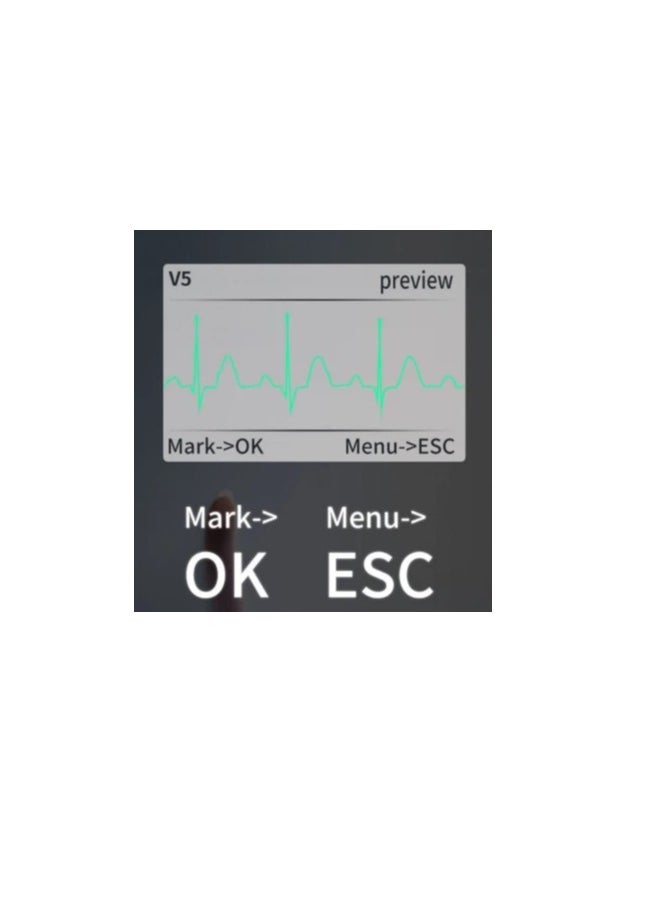 CONTEC TLC5000 Dynamic ECG System