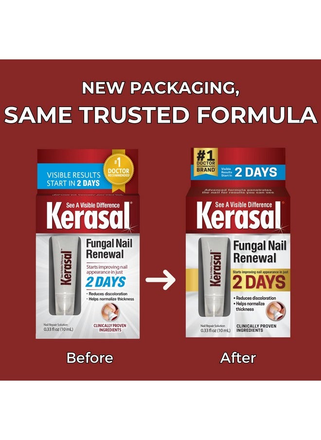 Kerasal Nail Renewal, Restores Appearance of Discolored or Damaged Nails, 0.33 fl oz (Packaging May Vary)