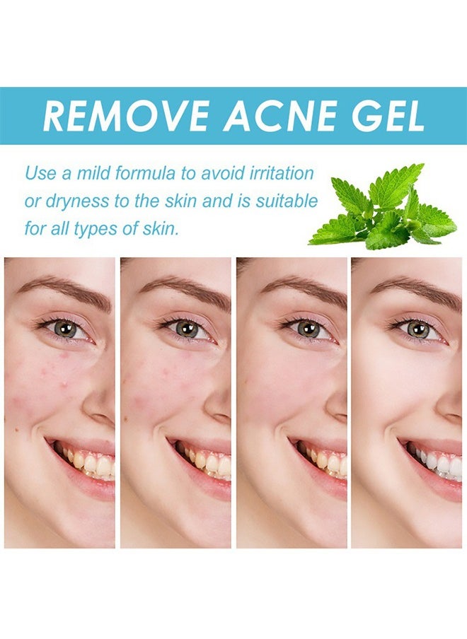 Salicylic Acid Salvia Mil Tiorrhiza Remove Acne Gel,Acne Control Gel, Salicylic Acid Acne Cream, Dark Spot Remover for Face, Spot Cream for Teens, Fades Acne Marks 20g