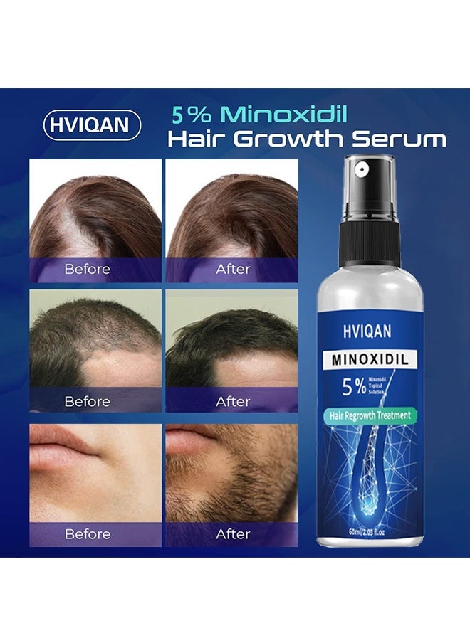 5% Minoxidil Topical Solution，Hair Growth Spray For Men and Women 60Ml Hair Regrowth Treatment Serum For Stronger Thicker Longer Hair Help to Stop Thinning and loss hair 60ml