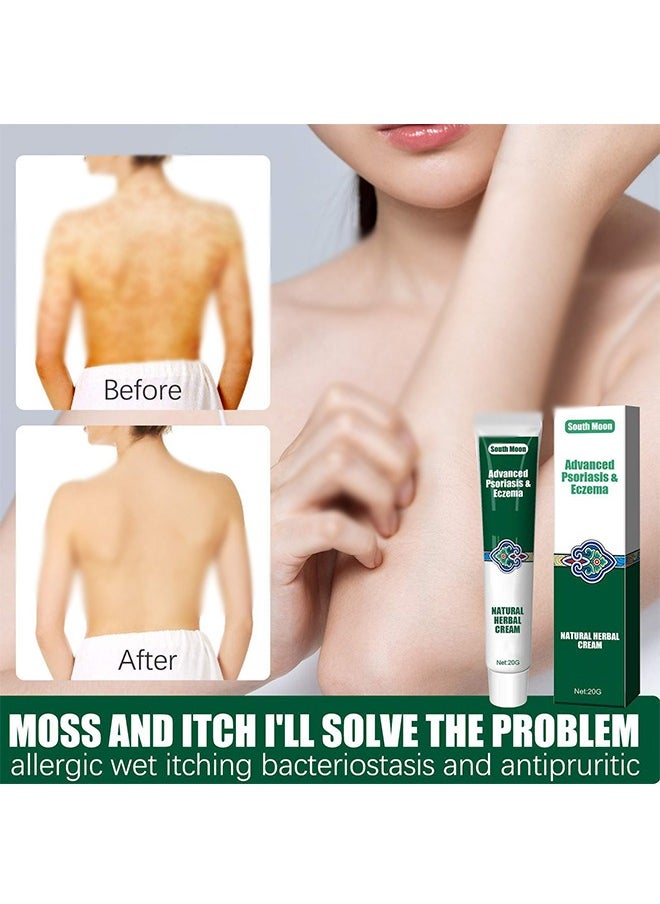 Advanced Psoriasis&Eczema Natural Herbal Cream，Organic Eczema Herbal Healing Cream, Chinese Herbal Eczema, Natural Herbal Cream, Psoriasis Ointment Cream, Moisturising Cream, Face Cream, Body Cream for Dry Skin, Itch Skin, Itch Relief Cream 20G