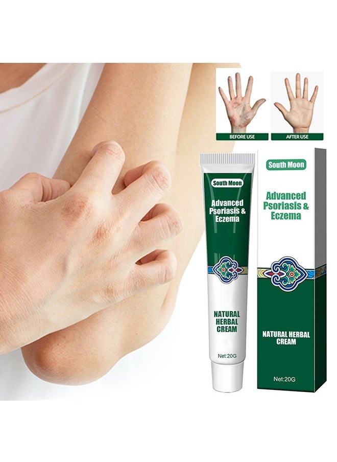 Advanced Psoriasis&Eczema Natural Herbal Cream，Organic Eczema Herbal Healing Cream, Chinese Herbal Eczema, Natural Herbal Cream, Psoriasis Ointment Cream, Moisturising Cream, Face Cream, Body Cream for Dry Skin, Itch Skin, Itch Relief Cream 20G