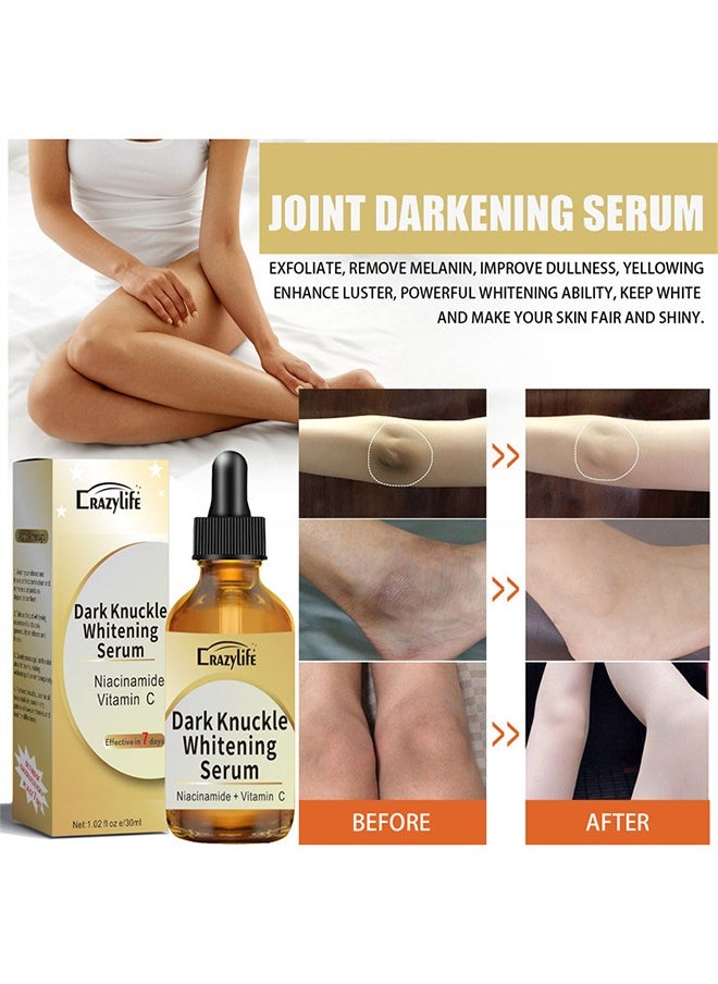 Dark Knuckle Whitening Serum, Joint Darkening Serum, Lighten And Repair Melanin, Skin Care Removal Body Bleaching For Knuckle Elbows 30ml