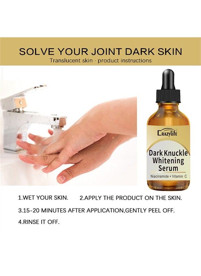 Dark Knuckle Whitening Serum, Joint Darkening Serum, Lighten And Repair Melanin, Skin Care Removal Body Bleaching For Knuckle Elbows 30ml