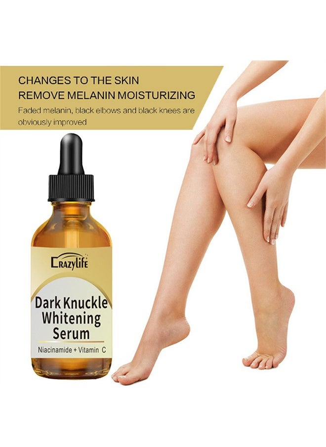 Dark Knuckle Whitening Serum, Joint Darkening Serum, Lighten And Repair Melanin, Skin Care Removal Body Bleaching For Knuckle Elbows 30ml