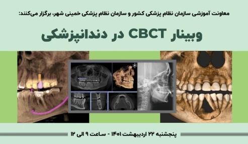 CBCT در دندانپزشکی