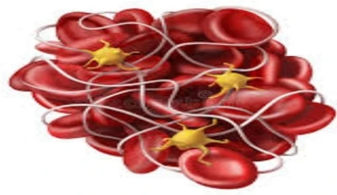 فصل ۵۰ میلر:Patient Blood  Management Coagulation