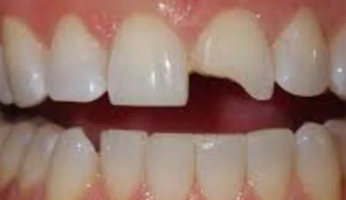 وبینار علمی مدیریت آسیبهای تروماتیک دندانی و راهکارهای درمانی آن
