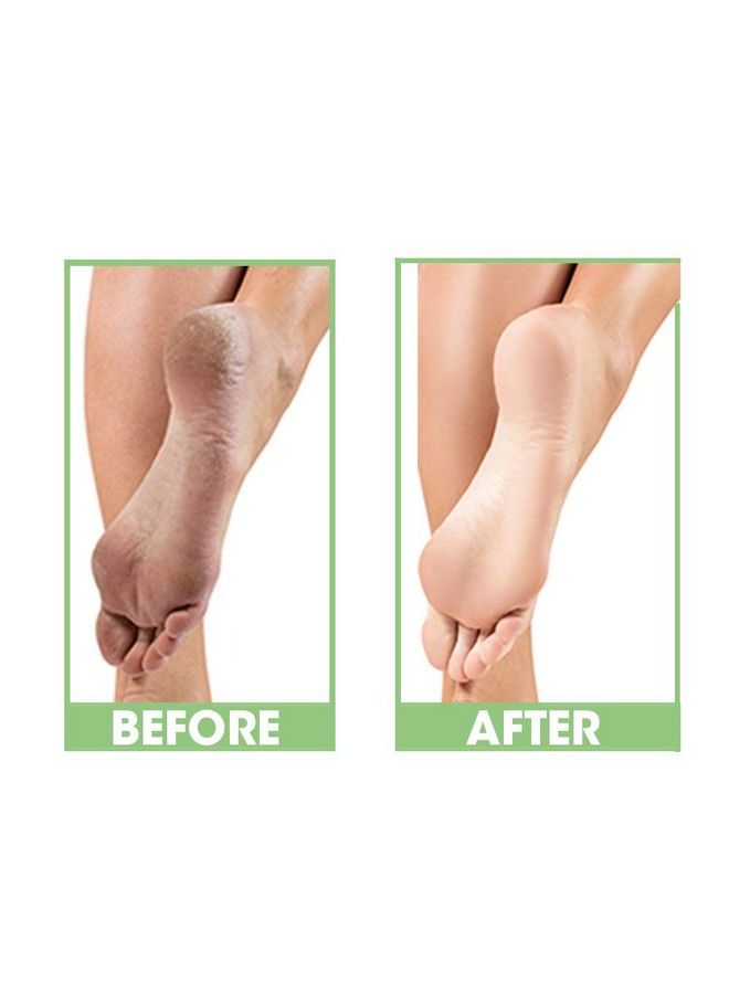 Dry Heel Eliminator Protect And Hydrate Dry Heels And Feet Fast Absorbing And Non Greasy Made In The Usa 4 Fl. Oz.