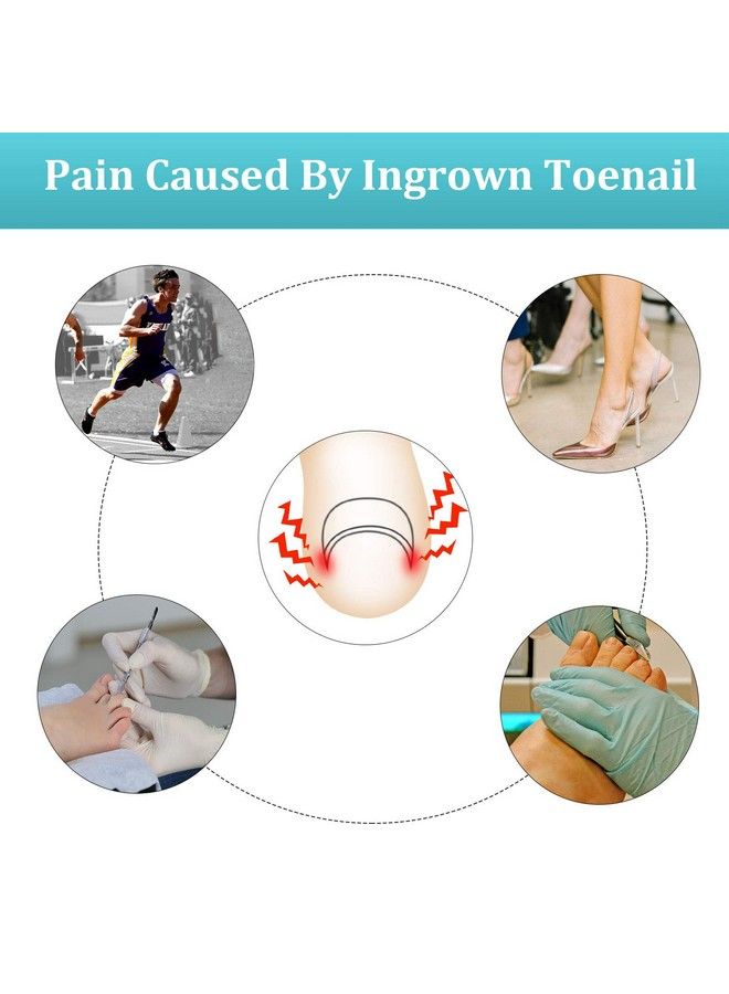 122 Pieces Ingrown Toenail Tool Set Include Ingrown Toenail File And Lifter 60 Pieces Elastic Patch Curved Toenails Brace Stickers And 60 Pieces Ingrown Toenail Correction Stickers