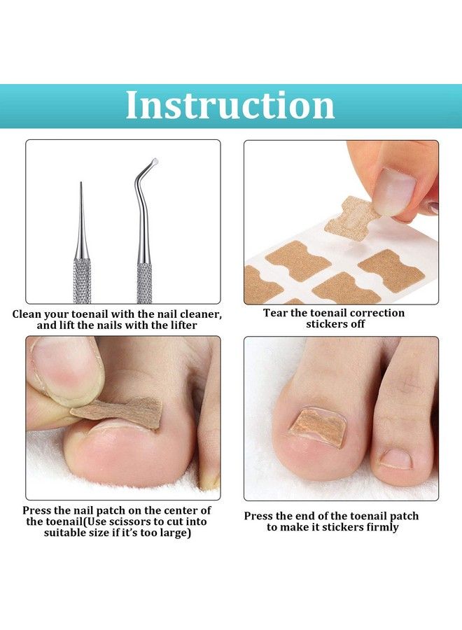 122 Pieces Ingrown Toenail Tool Set Include Ingrown Toenail File And Lifter 60 Pieces Elastic Patch Curved Toenails Brace Stickers And 60 Pieces Ingrown Toenail Correction Stickers